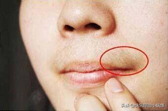 多囊卵巢囊肿怎么治疗效果最好,多囊卵巢和巧克力囊肿哪种更严重