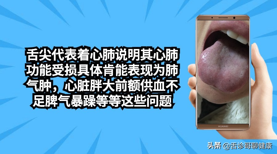 舌诊歌舌象分析与感悟,舌诊哥聊健康痰湿