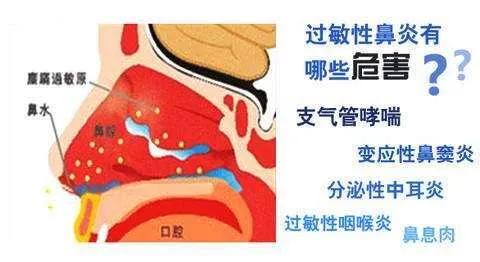 孩子咳嗽鼻塞流鼻涕中医食疗,小儿鼻塞流鼻涕咳嗽推拿手法