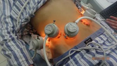 白癜风激光治疗和光疗有什么不同,白癜风光疗要配合药物吗