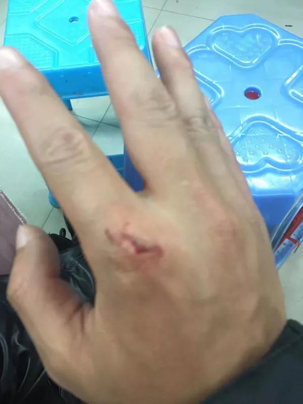 接到“两个不锈钢脸盆”订单？外卖小哥选择报警……