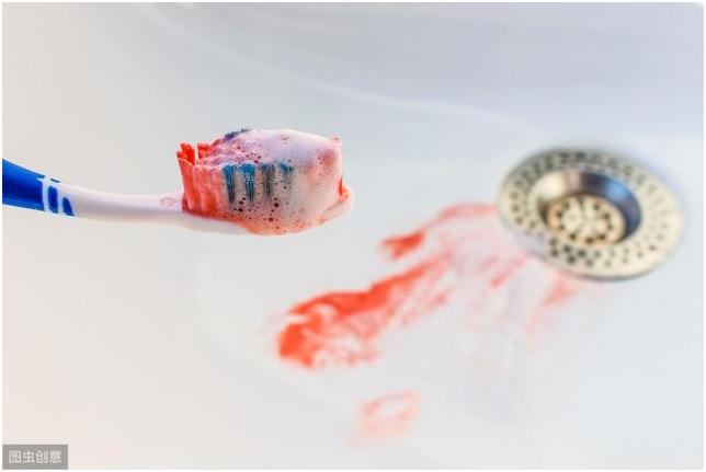 牙周炎引起的口腔溃疡久治不愈,上火引起的牙周炎怎么治疗