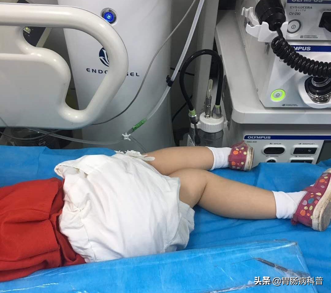 儿童拉血直肠息肉怎么治,3岁的孩子直肠息肉排便带血
