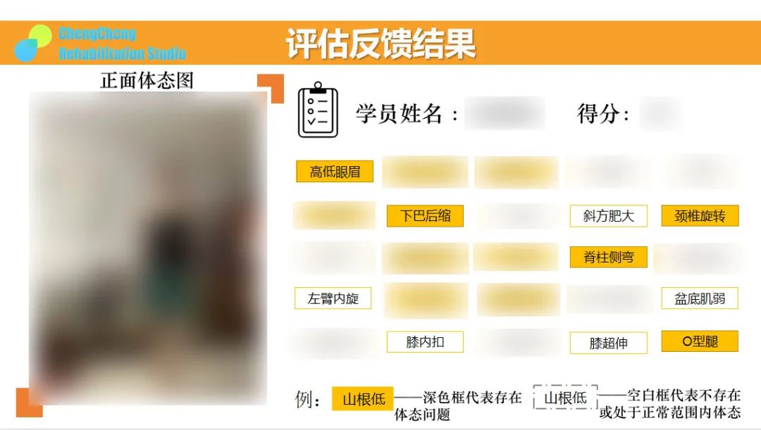 从下颚后缩到完美侧颜,侧颜杀杀手