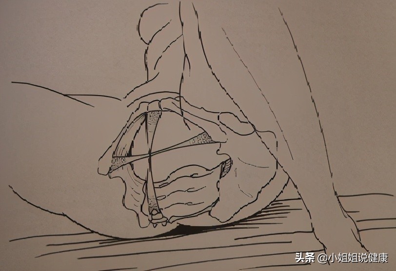 盆底锻炼除了凯格尔还有哪些,凯格尔运动能锻炼盆底深层肌肉吗