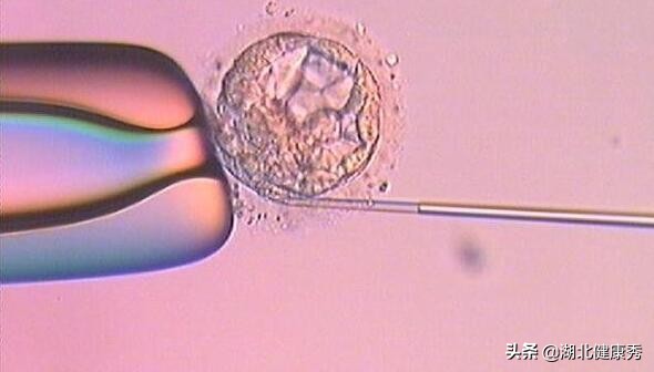 试管婴儿促排卵,只要跨过这3道坎,算是成功了一半