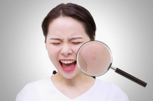 保湿霜会爆痘吗,用了保湿霜起痘痘