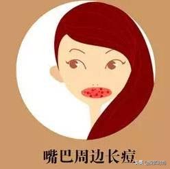 戴口罩起痘、皮肤压伤？关于非常时期的10个皮肤问题一次性解决