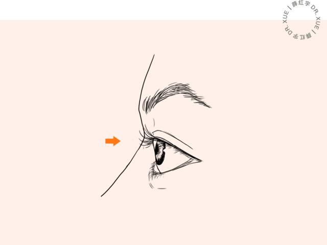 三层眼皮女人的特点,哪种眼皮最好看