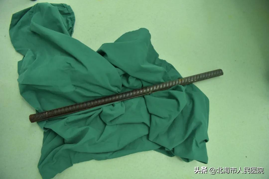 工人被钢筋刺穿身体生死一线抢救,工地钢筋穿过人体事故后续