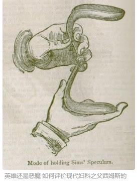 惊叹“鸭嘴形窥器”的前世今生