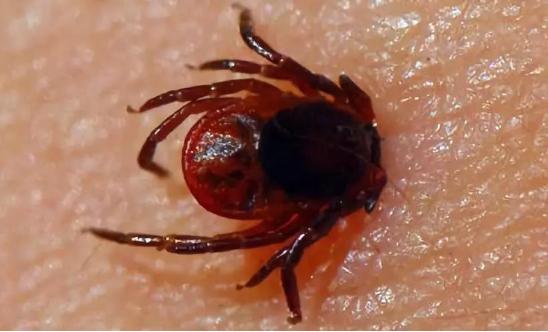 虫子叮咬引发疾病,虫子叮咬会得什么病