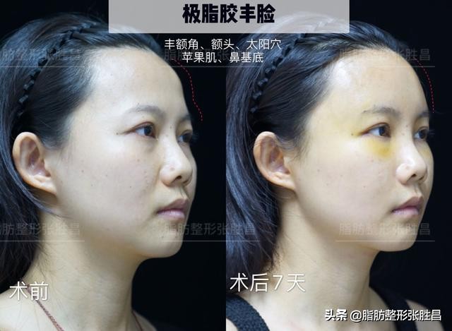 快速有效暴瘦腰腹练出马甲线,紧致身材零赘肉这样健身才最有效