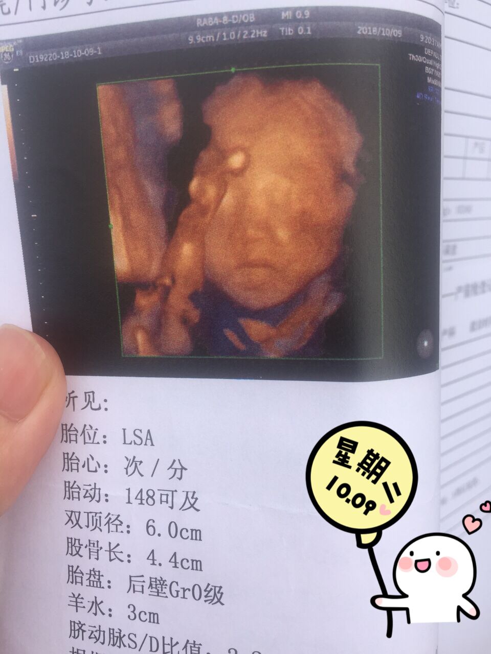 孕晚期如何正确数胎动,孕晚期如何正确数胎动的次数