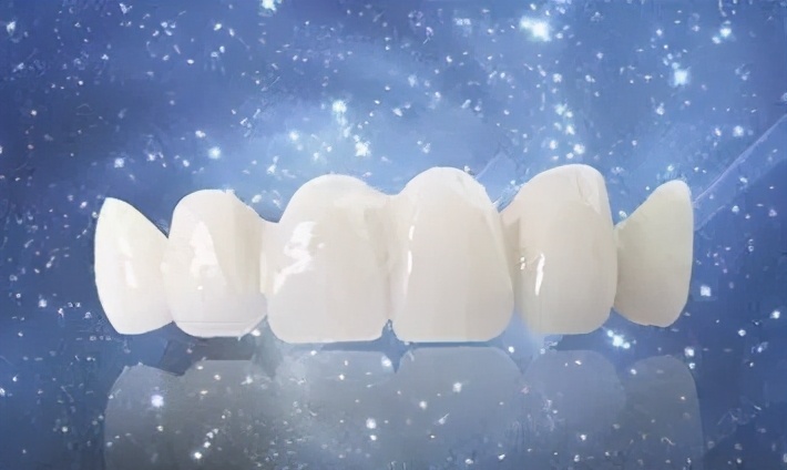 三甲医院全瓷牙保质期,全瓷牙有缝隙保质期是多久