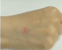 炉甘石不可以涂哪里,炉甘石不能配伍中药