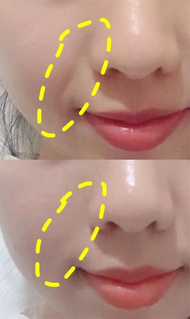 抗衰老蜗牛,蜗牛护肤品抗皱抗衰老