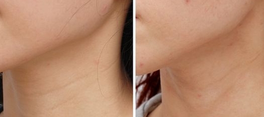 不起眼的老牌国货效果不输给兰蔻,国货中的良心