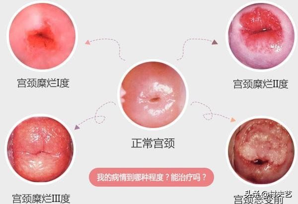 体检常见的六种病,体检常见的10种症状