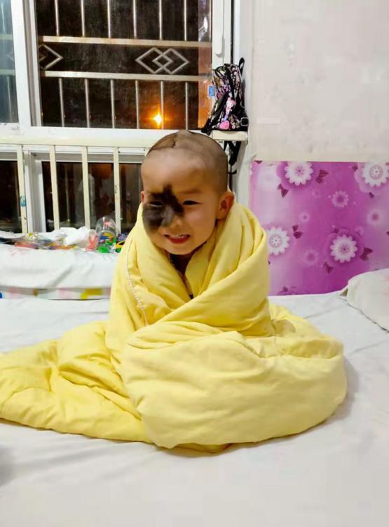 5岁男孩头上长500克重“气球”，历尽5年艰辛只为早日换脸