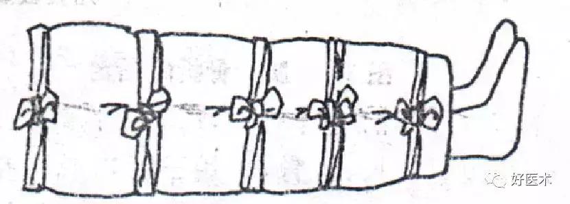 骨科急救处理流程图,骨科急救原则及注意事项