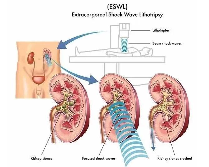 开刀手术简单还是微创简单,开刀好还是保守治疗好