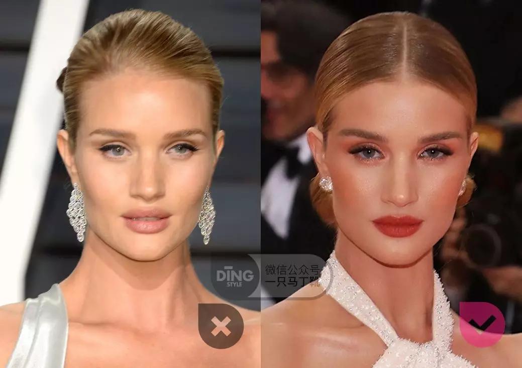 颧弓高脸型怎么改善,有泪沟可以通过调整脸型改善嘛