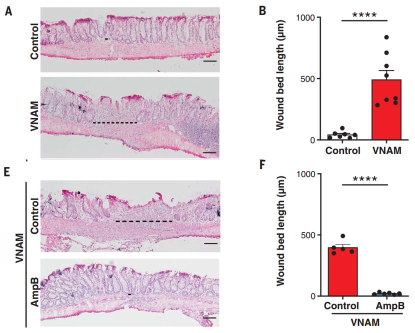 奶酪可以改善肠道吗,奶酪里有酵母菌