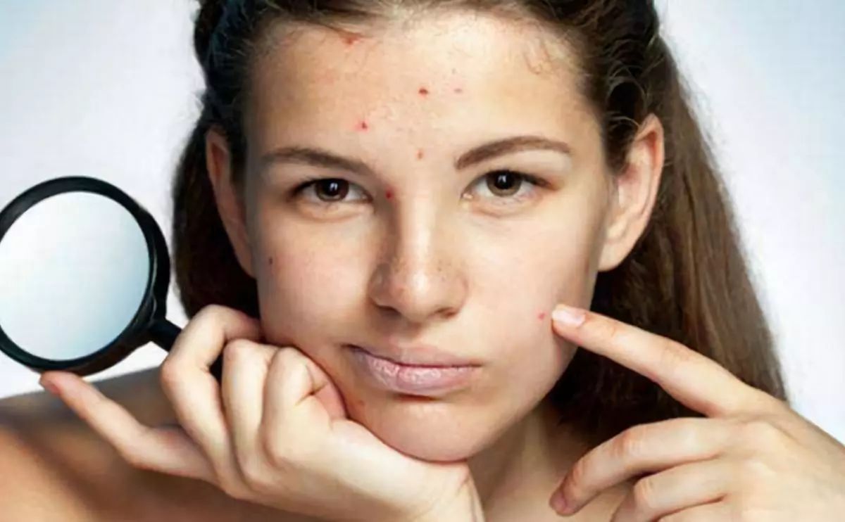 脸上有痘印怎样遮痘不显厚,脸上的痘印用遮瑕怎么遮