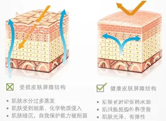 角质层薄用薇诺娜能增厚角质层吗,皮肤角质层薄薄的怎样增厚角质层