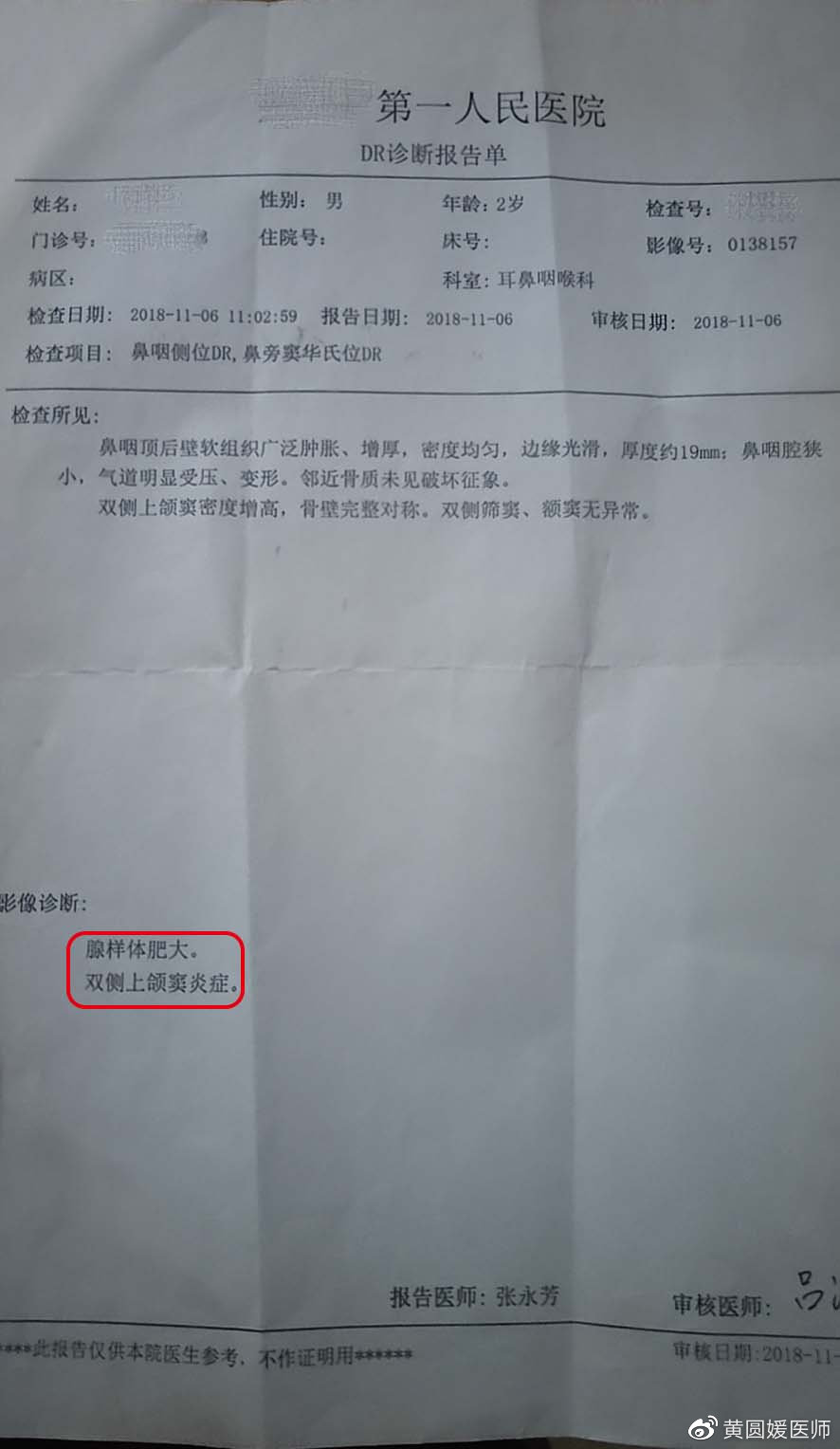 鼻炎总是治标不治本,鼻炎老是不断根