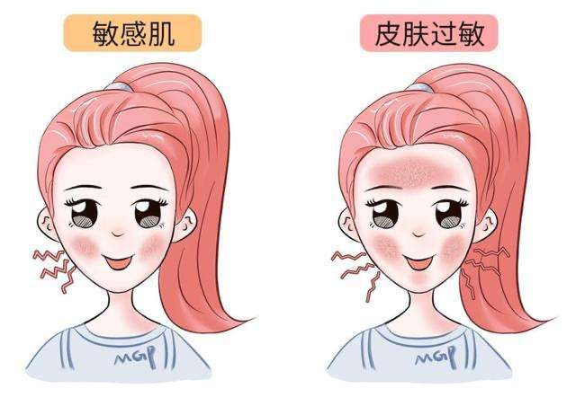 修复泛红面膜推荐平价学生党,平价面部修复面膜推荐