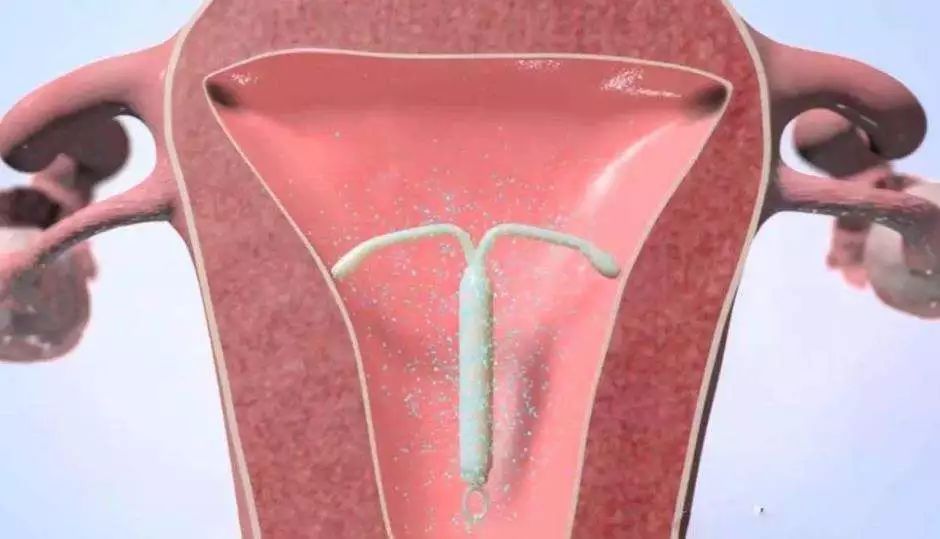 22岁女孩做6次人流,25岁女生人流两次