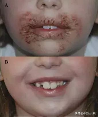 新安怡和nuk湿巾哪个好,婴儿湿巾测评微量防腐剂