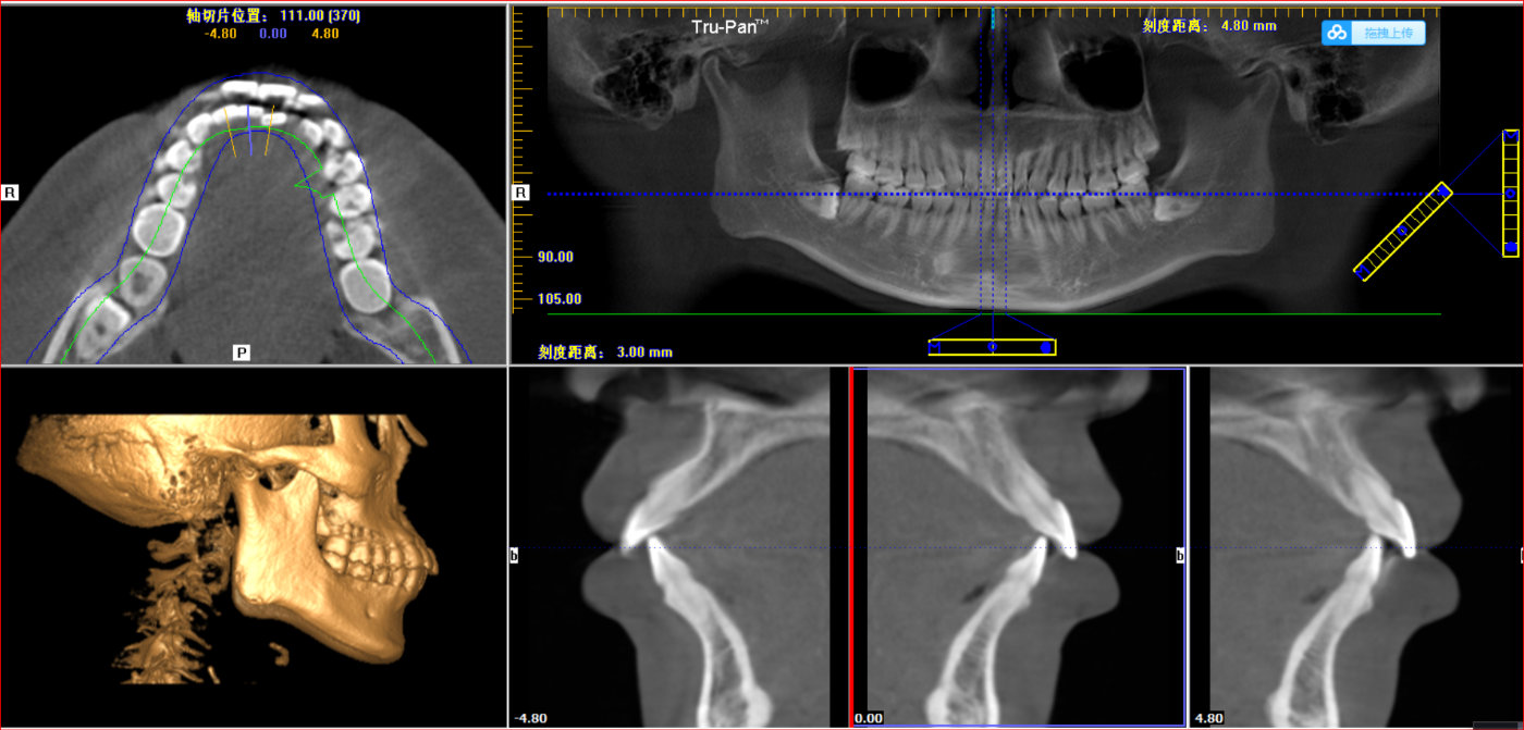 正畸医生杨磊,北大口腔医院修复科杨磊