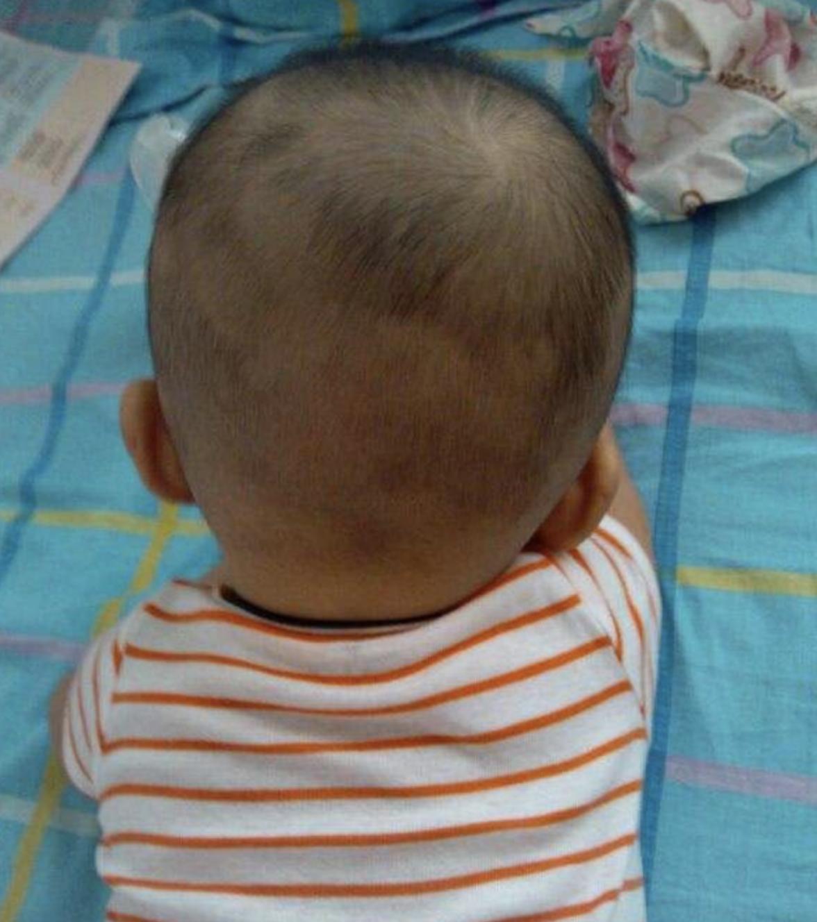 宝宝后脑勺高就是高智商的象征,有前脑勺后脑勺宝宝聪明吗