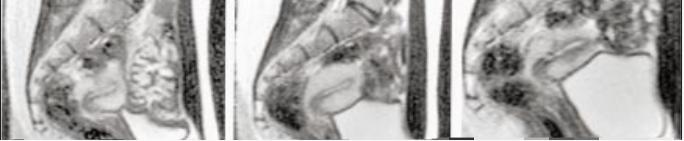 为了研究人类*行为性**，科学家利用核磁成像技术拍下了整个过程