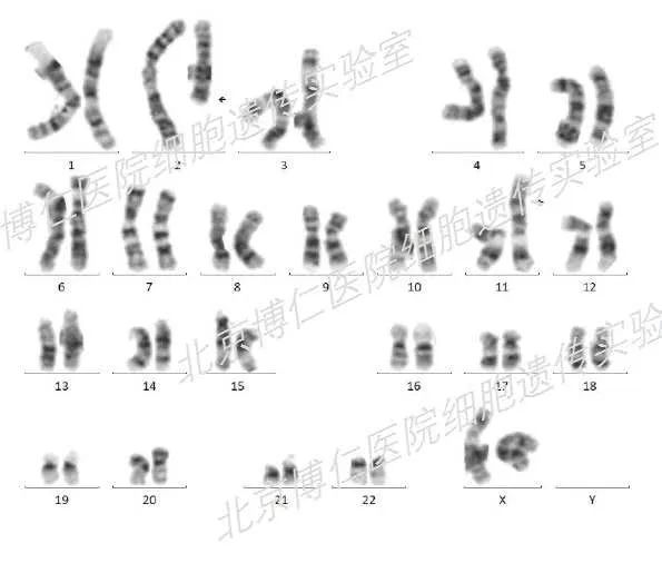 靶向药没有效果重新做基因检测,靶向治疗第二次没有基因突变