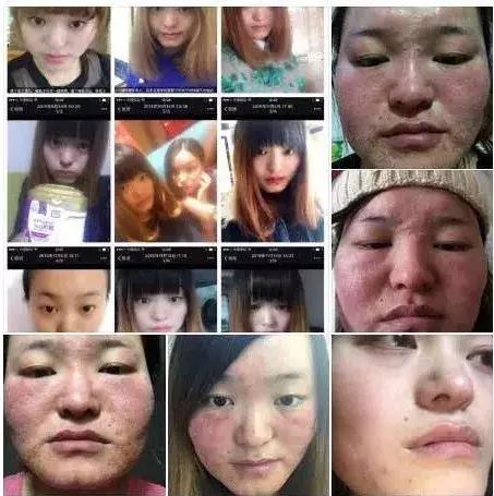 21亿智商税?屡遭质疑的微商面膜如此赚钱!林志玲陶虹都陷入了