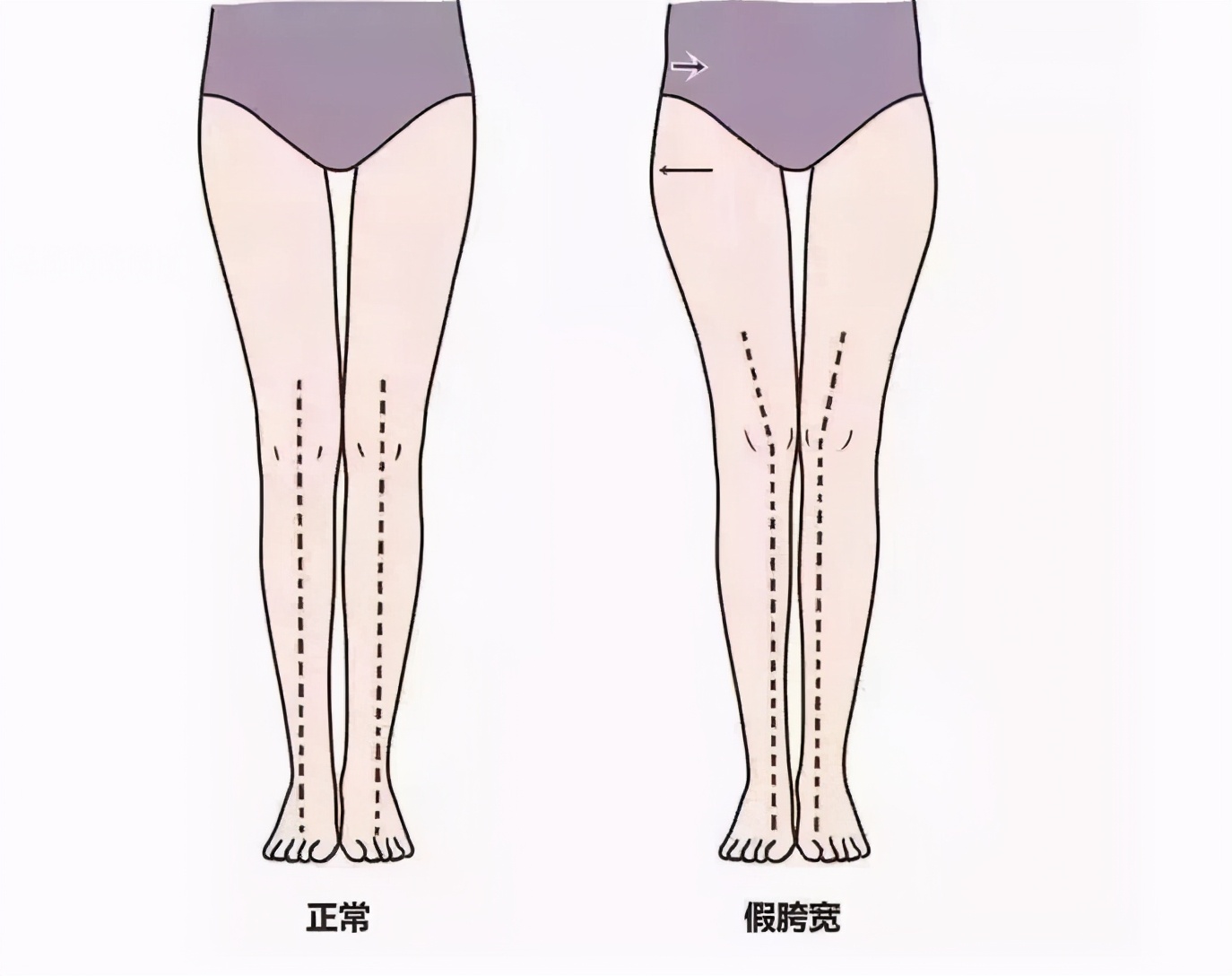 铅笔腿怎么练又直又细,腿一定要细才好看吗