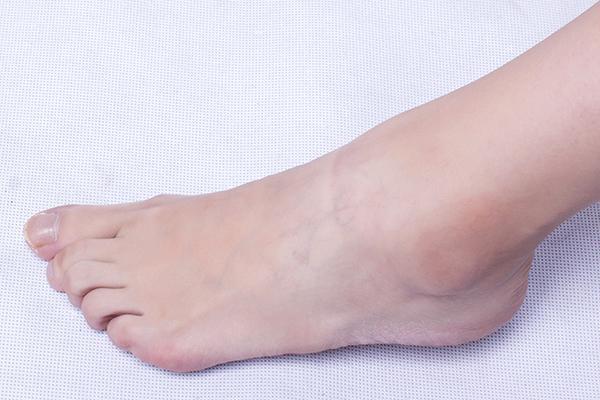 如何从鞋底磨损判断身体问题,鞋底各部位磨损与什么有关