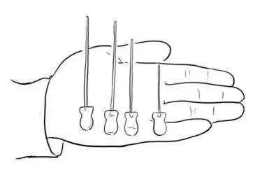 小针刀帮大忙，畸形3年伸不直的膝盖终有治
