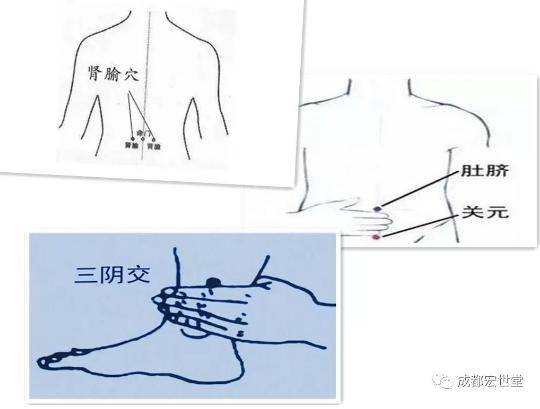 灵枢易针单纯性甲状腺肿大患者的福音——宏世堂今日干货分享