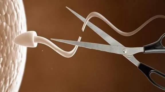 夫妻谁去结扎最好,夫妻两人谁结扎好一点