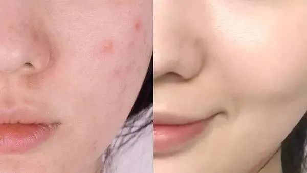 好用的蓝铜肽精华,蓝铜肽精华液抗老