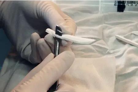 韦敏整形价格,九院韦敏聊整形