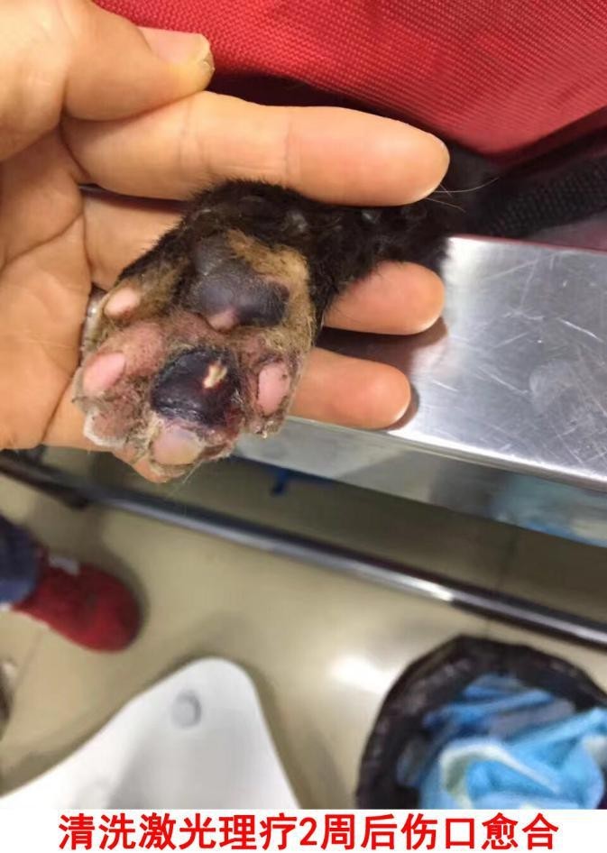 激光治疗脚跖疣方法,激光治疗脚垫视频