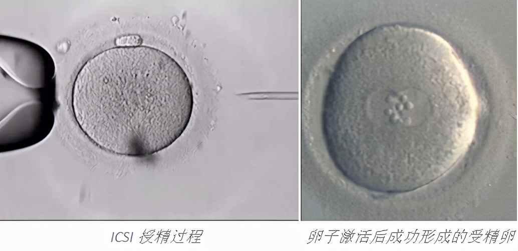 雄风再起全部视频,雄风再起完整版原唱