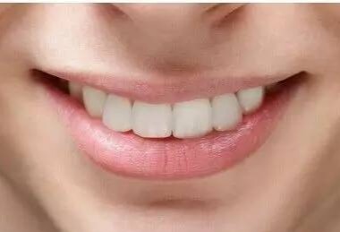 牙齿的全部疾病及治疗方法,常见的四种牙齿问题你占了几种