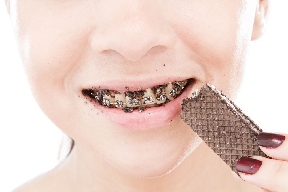 戴牙套是什么感受,戴牙套是什么体验的视频